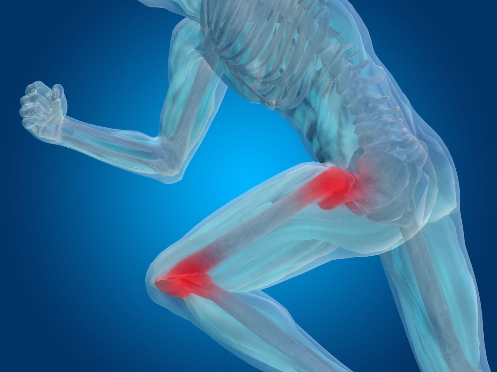 Treating Hip Bursitis with Stem Cell Therapy, Fort Collins Back Pain