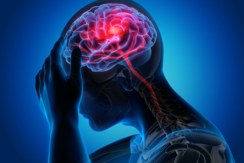 Are Headaches Considered Chronic Pain