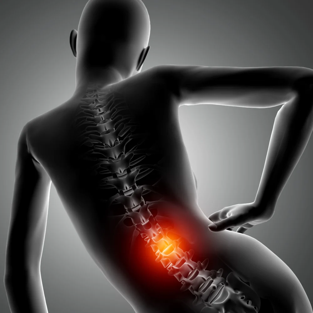 https://mvmhealth.com/storage/2023/12/Beyond-the-Back-The-Unspoken-Truth-of-Multifidus-Pain-in-Your-Spine-1000x1000.webp