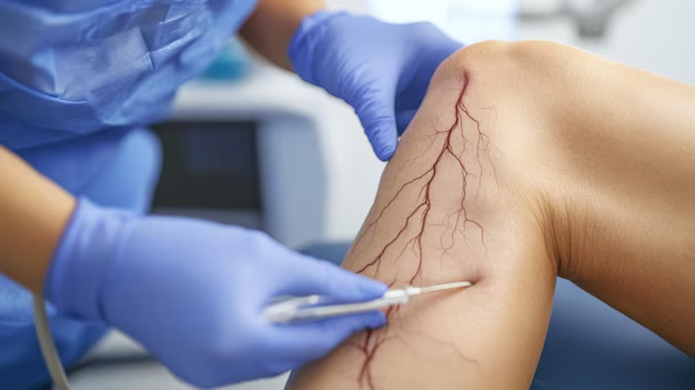 Top Signs You Should Visit a Vein Specialist for Varicose Veins