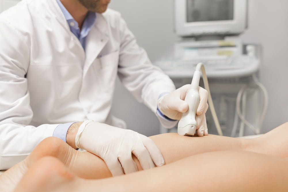 varicose vein treatments
