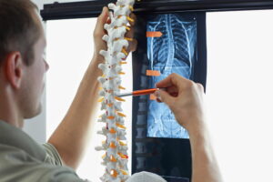 MVM Health doctor analyzing spinal X-ray alongside anatomical spine model for diagnosis