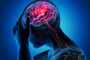 Chronic headache and brain pain visualization for patients seeking relief at MVM Health