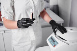 PRP therapy preparation with blood sample and centrifuge machine in MVM clinic