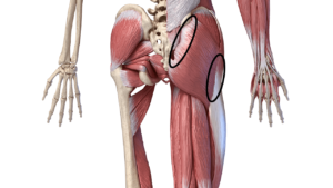 highlighting Buttock Pain After Hip Replacement?
