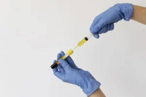 PRP injection preparation with syringe and blood sample in medical laboratory.