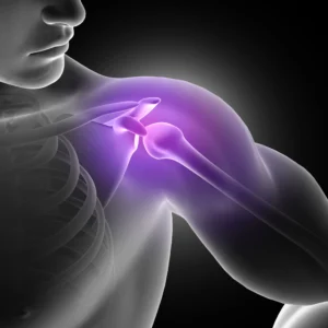 3D illustration of Navigating a Torn Rotator Cuff's Recovery Without Surgery
