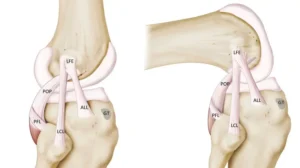 3D illustration off Beyond the Surface which is highlighting the Hidden Causes of Outer Knee Discomfort