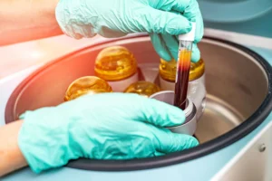 PRP blood sample being placed in a centrifuge machine for platelet-rich plasma preparation.