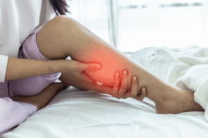 A young girl is holding her leg as she is suffering from Varicose Vein