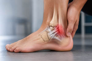 Not Sure If It's a Deltoid Ligament Injury?