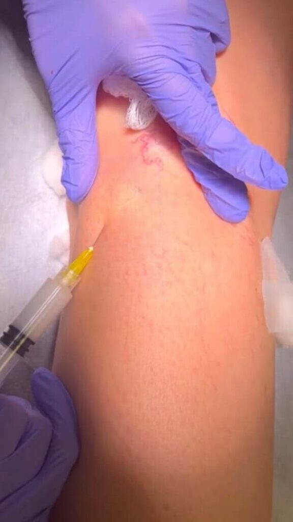 Vein Health