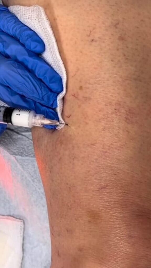 Vein Health