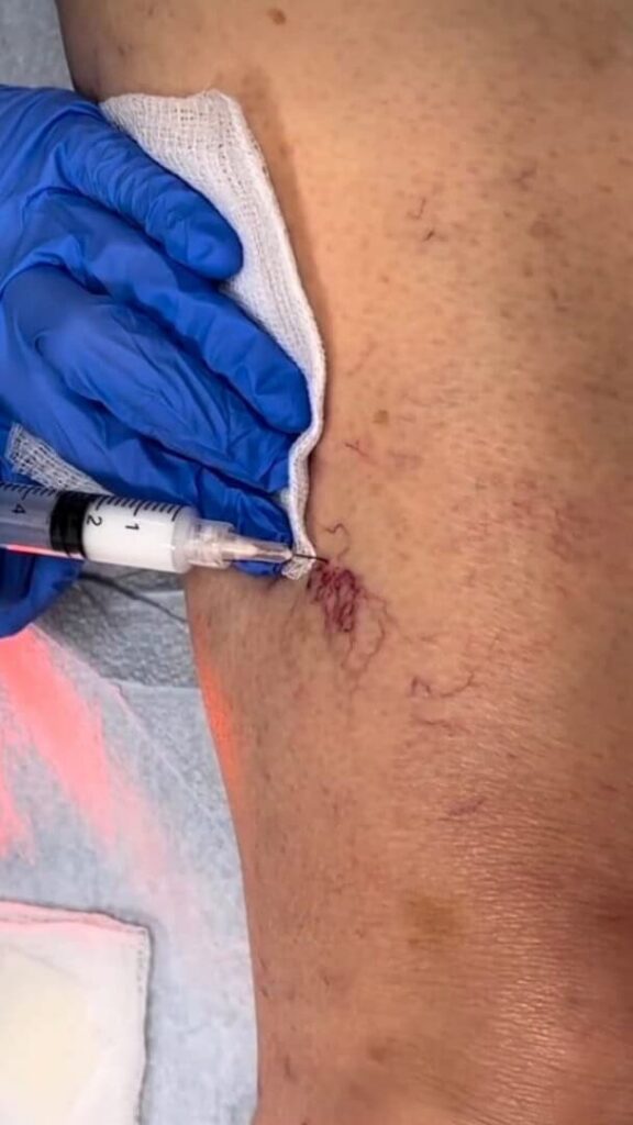 Vein Health