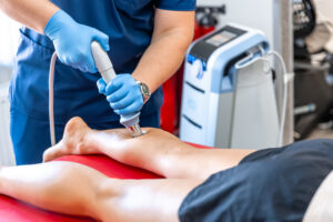Sclerotherapy Permanently Remove Spider Veins