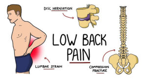 back pain down leg