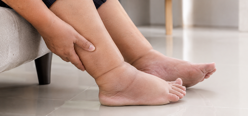 Why Are My Ankles Swollen Every Evening? Common Vein-Related Causes Explained