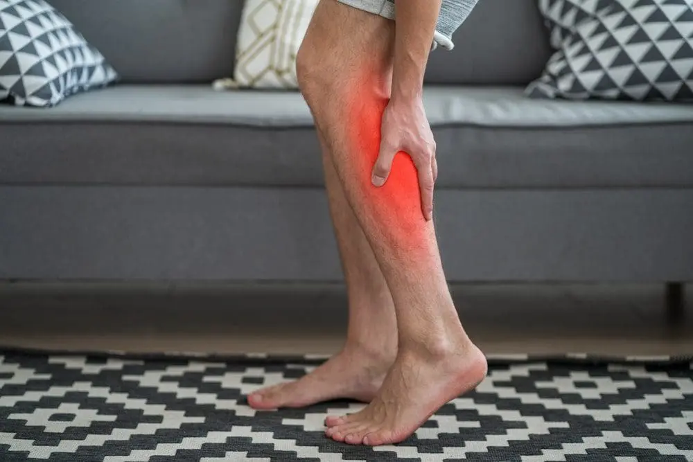 Varicose Vein