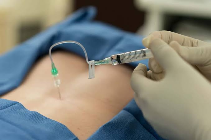 Pain Treatment in East Stroudsburg,Pain Treatment