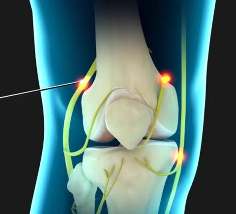 Pain Treatment in East Stroudsburg,Pain Treatment