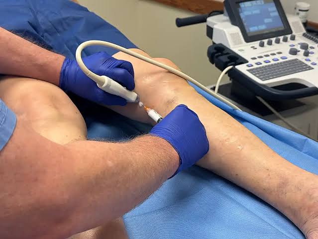 Vein treatment in reading,Vein Treatment,Vein Care,Vein Clinic in Reading