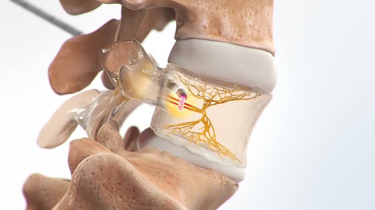 Pain Treatment in East Stroudsburg,Pain Treatment