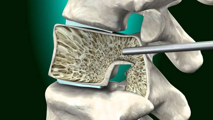 Pain Treatment in East Stroudsburg,Pain Treatment
