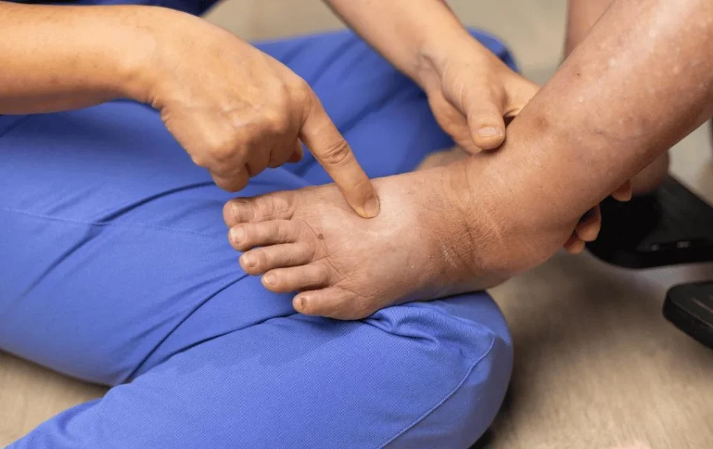 Vein Treatment,Vein Treatment Options